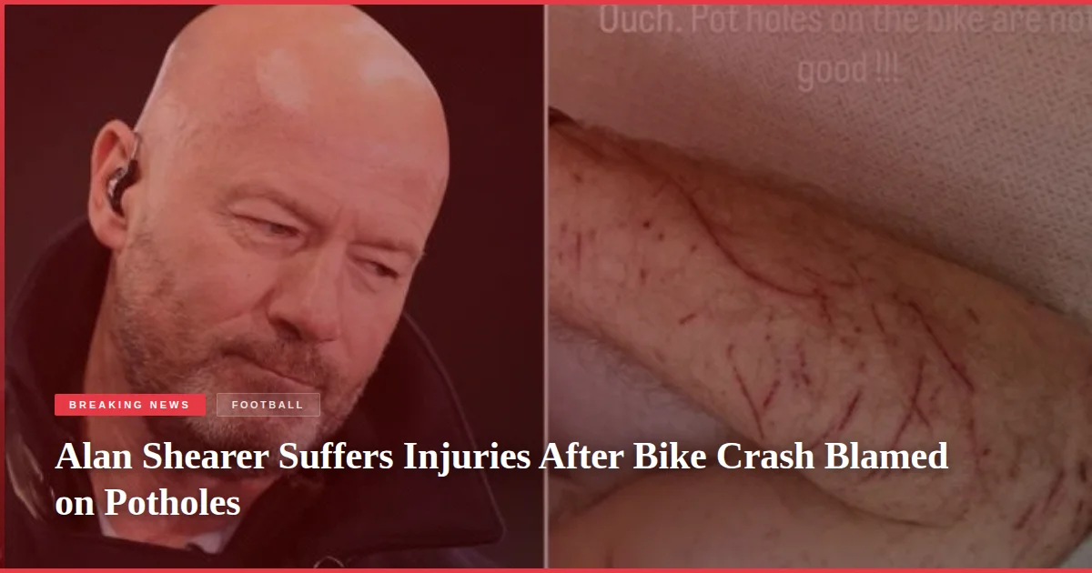 Alan Shearer Suffers Injuries After Bike Crash Blamed on Potholes